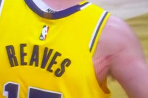 猛龍主帥說里夫斯哨子多？??里夫斯后背&手臂已被撓出“獸痕”