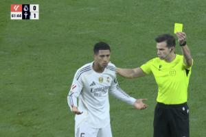 沒給牌！貝林頭部遭肘到出血，之后反因未經(jīng)允許入場染黃